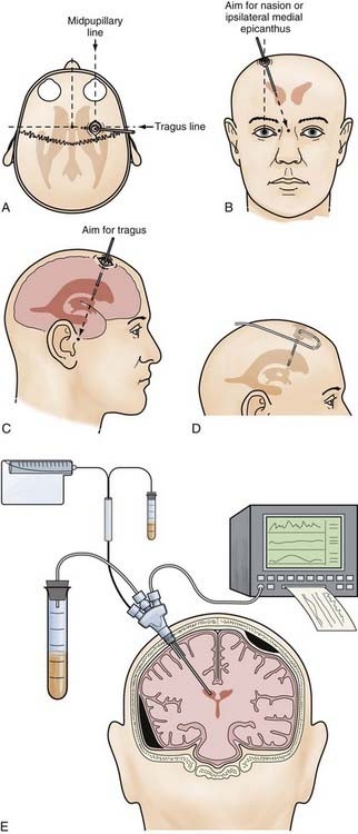 dating with brain injury